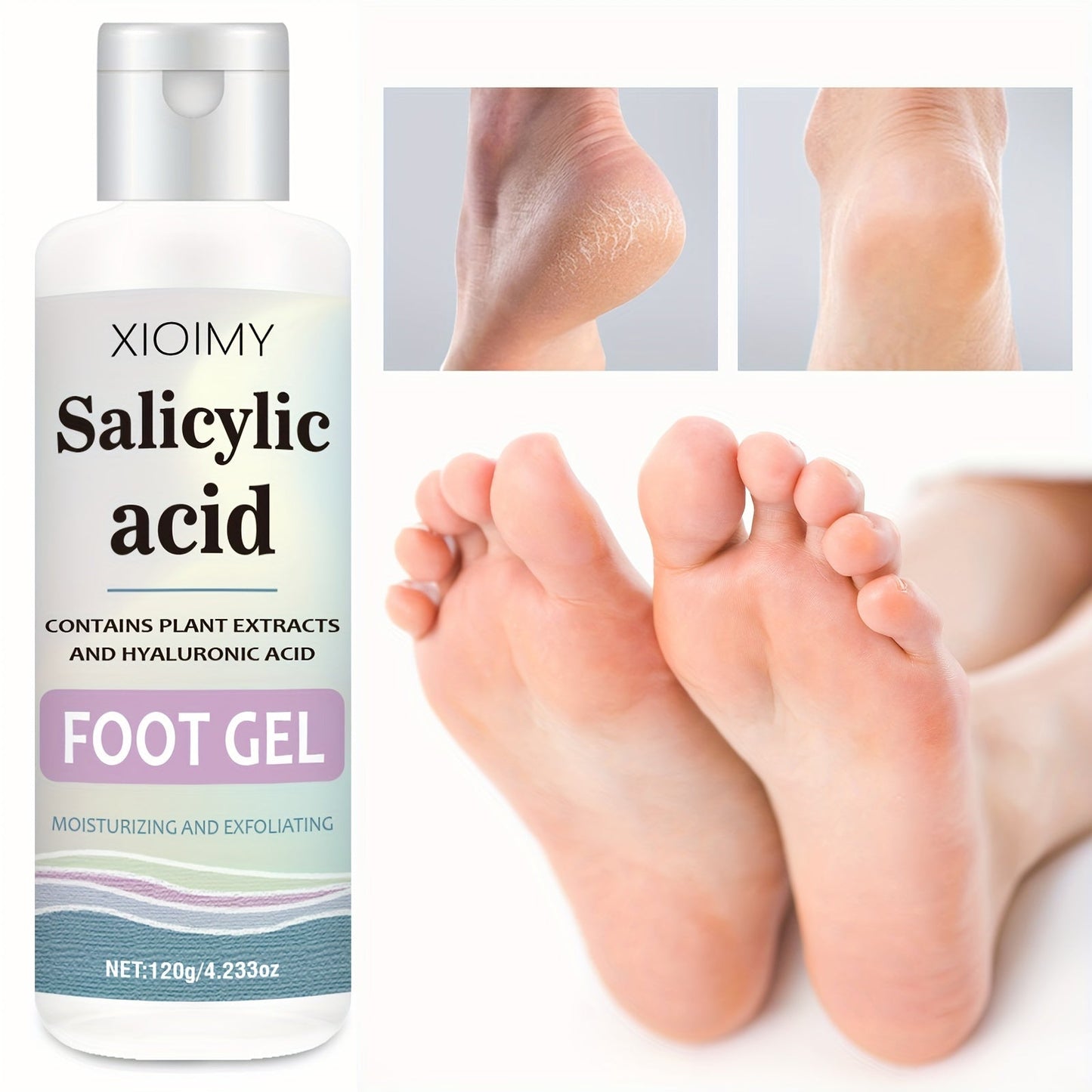 Salicylic Acid Foot Gel – Exfoliating and Moisturizing Heel Cream for Dry Cracked Feet, Smooth Callus Removal, Nourishing Daily Repair Foot Treatment
