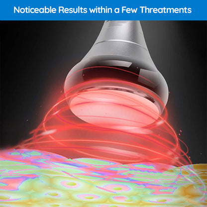 Ultrasonic Cavitation Machine