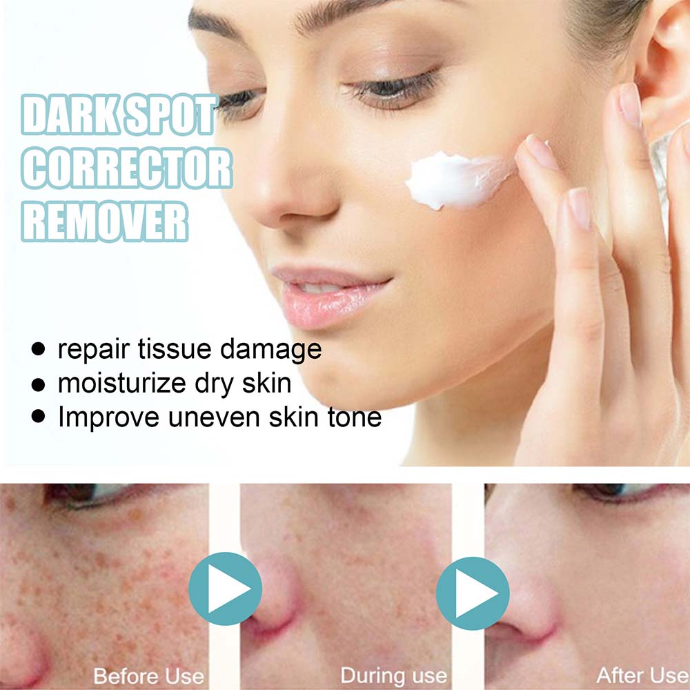 Dark Spot Fading Cream with Nicotinamide and Hydrating Blend for All Skin Types
